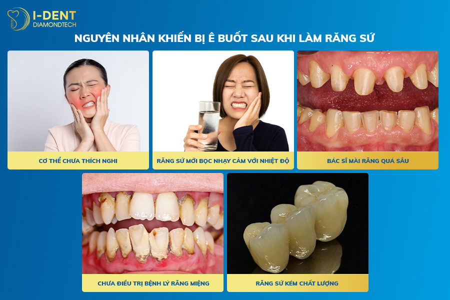 bọc răng sứ bao lâu hết ê buốt