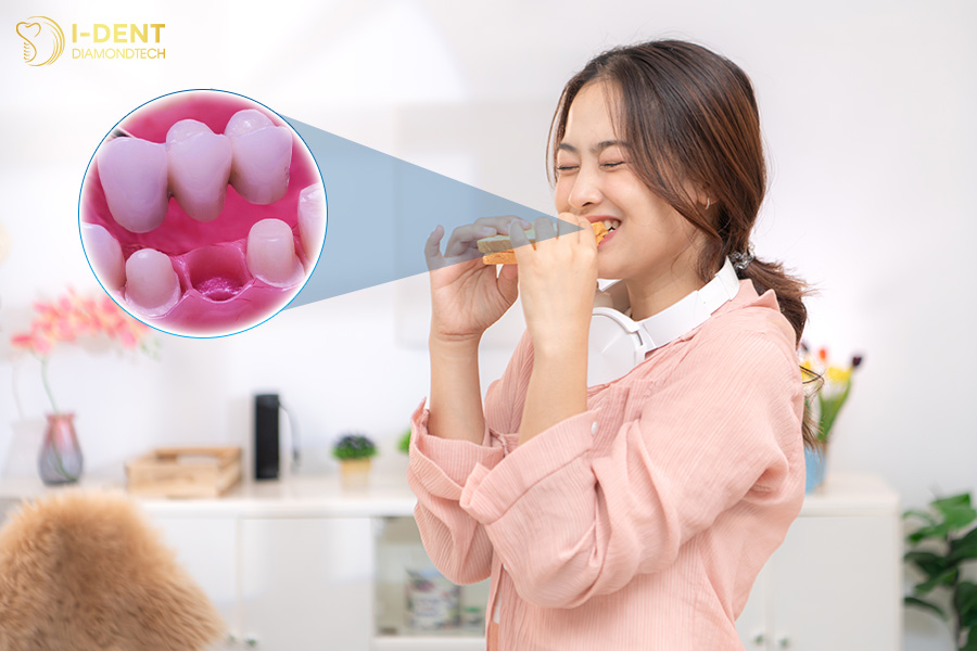 hình ảnh cầu răng sứ