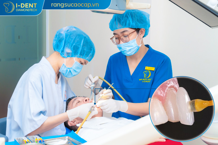 công nghệ làm răng sứ không mài